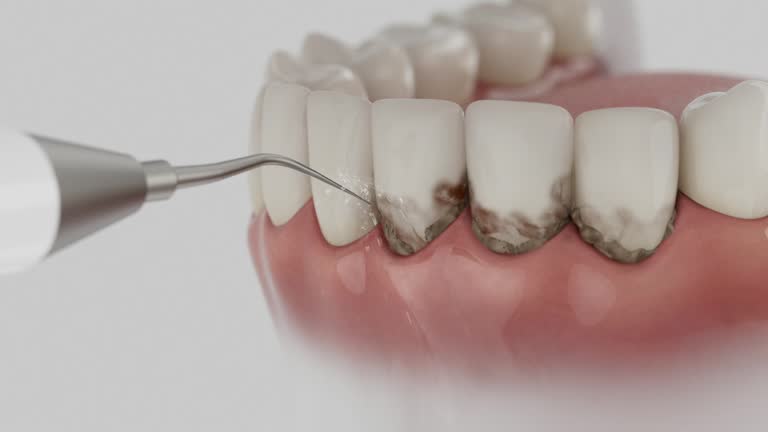Trusted Dental Implants service in Concord, MI - Dentist Open Now